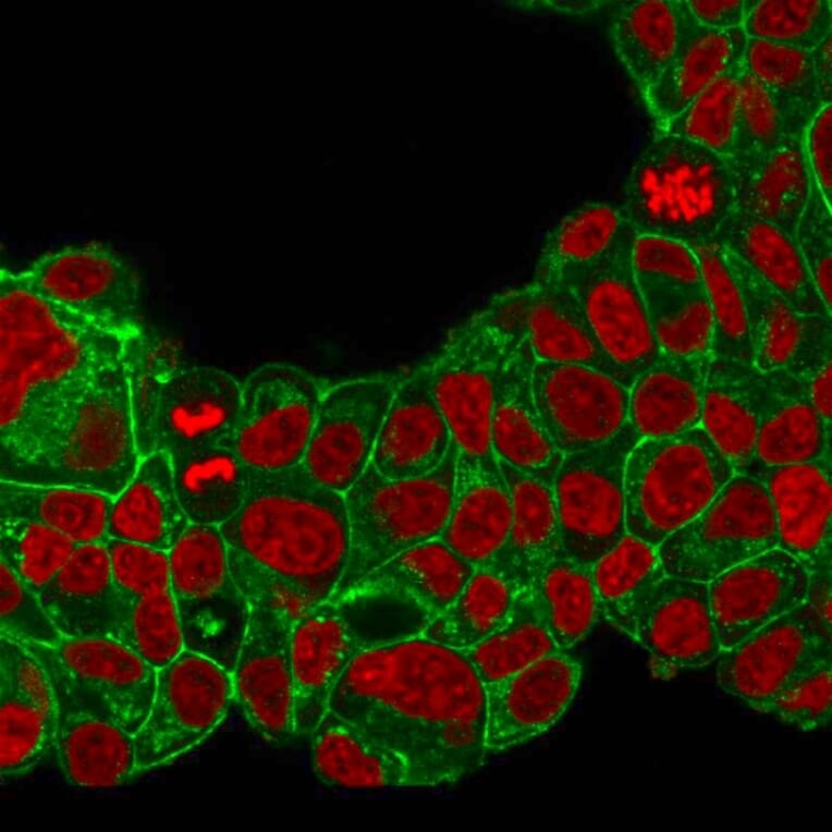 Immunofluorescence - Anti-HER2 Antibody [ERB2/776] - BSA and Azide free (A251638) - Antibodies.com