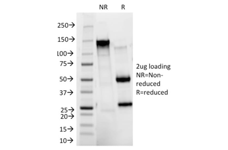 SDS-PAGE - Anti-HER2 Antibody [HRB2/273] - BSA and Azide free (A251639) - Antibodies.com