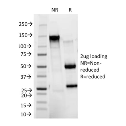 SDS-PAGE - Anti-HER2 Antibody [HRB2/273] - BSA and Azide free (A251639) - Antibodies.com