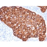 Immunohistochemistry - Anti-HER2 Antibody [ZR5] - BSA and Azide free (A251640) - Antibodies.com