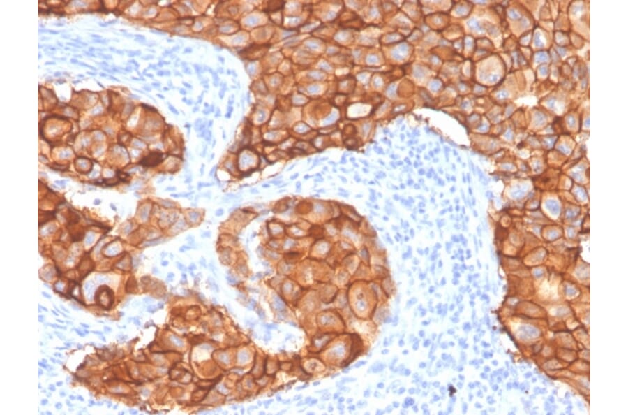 Immunohistochemistry - Anti-HER2 Antibody [ZR5] - BSA and Azide free (A251640) - Antibodies.com