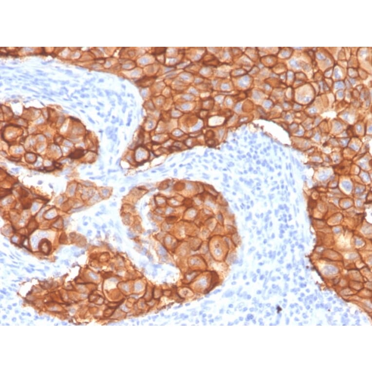 Immunohistochemistry - Anti-HER2 Antibody [ZR5] - BSA and Azide free (A251640) - Antibodies.com