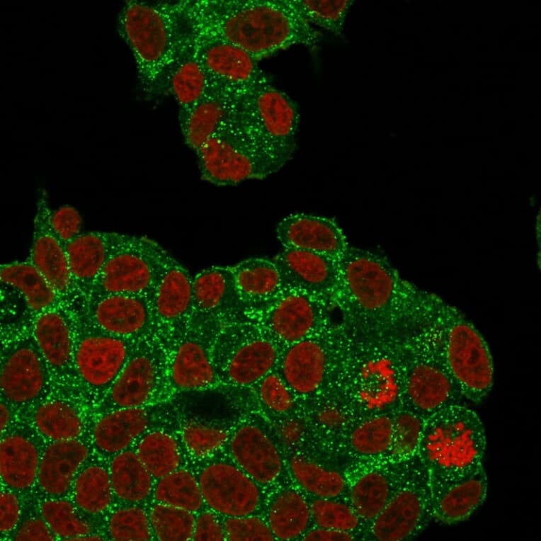 Immunofluorescence - Anti-HER2 Antibody [ZR5] - BSA and Azide free (A251640) - Antibodies.com