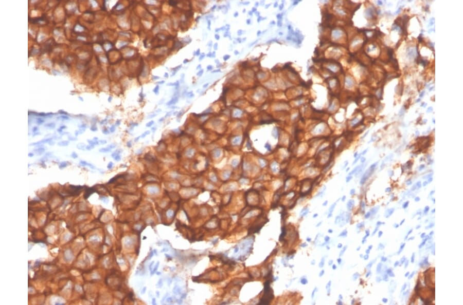 Immunohistochemistry - Anti-HER2 Antibody [ERBB2/4439] - BSA and Azide free (A251641) - Antibodies.com