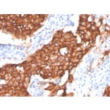 Immunohistochemistry - Anti-HER2 Antibody [ERBB2/4439] - BSA and Azide free (A251641) - Antibodies.com