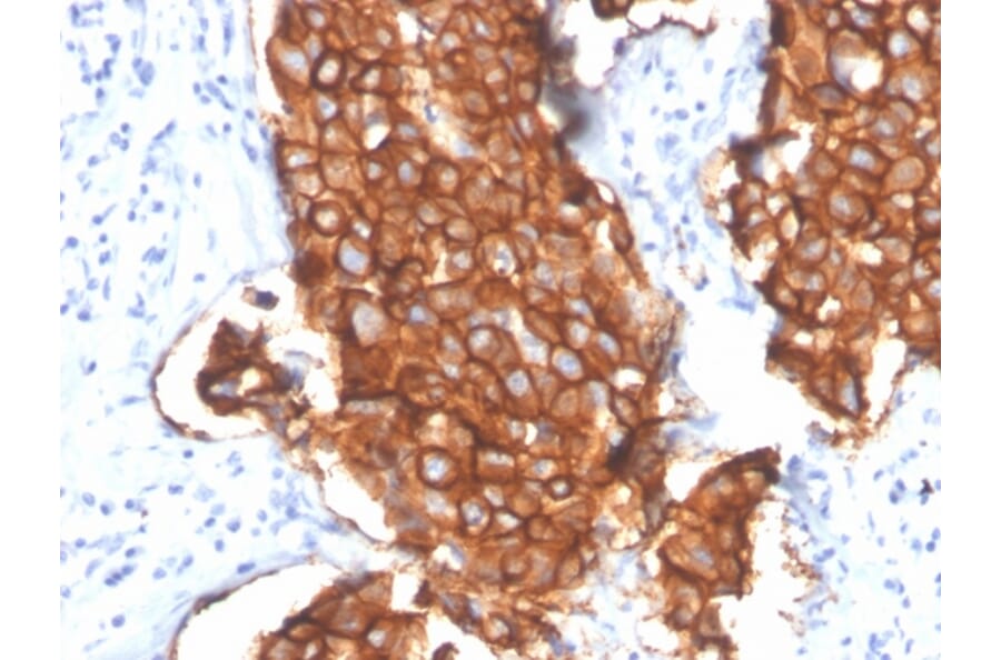 Immunohistochemistry - Anti-HER2 Antibody [ERBB2/4439] - BSA and Azide free (A251641) - Antibodies.com