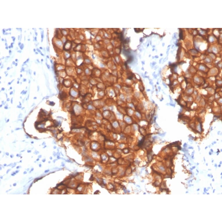 Immunohistochemistry - Anti-HER2 Antibody [ERBB2/4439] - BSA and Azide free (A251641) - Antibodies.com