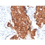 Immunohistochemistry - Anti-HER2 Antibody [ERBB2/4439] - BSA and Azide free (A251641) - Antibodies.com