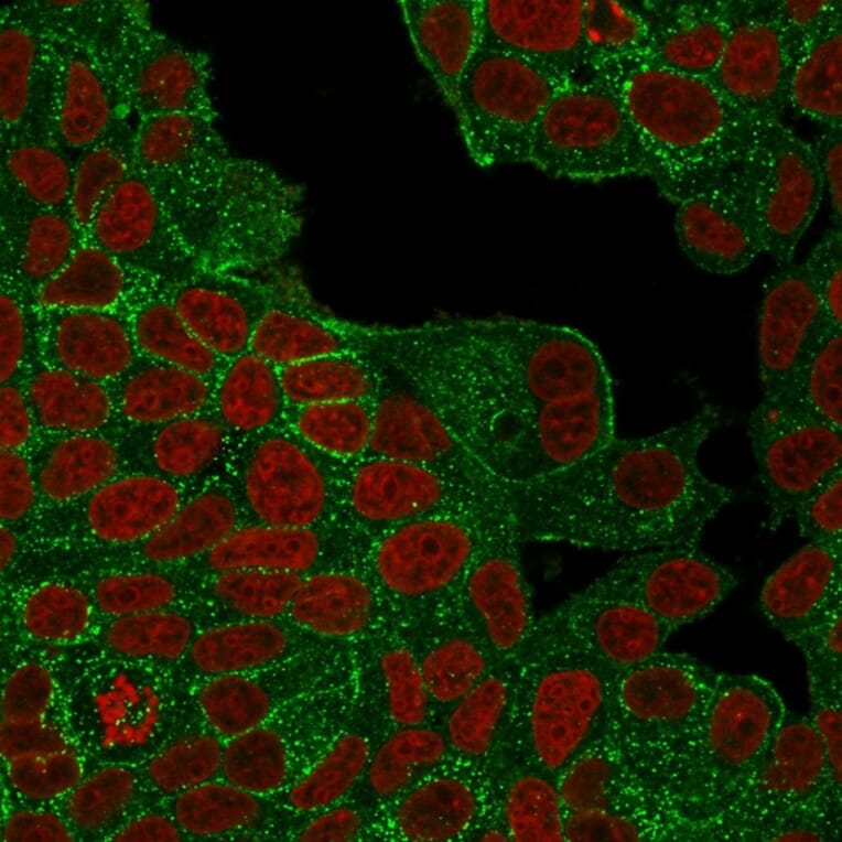 Immunofluorescence - Anti-HER2 Antibody [ERBB2/4439] - BSA and Azide free (A251641) - Antibodies.com