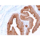 Immunohistochemistry - Anti-HER4 Antibody [ERBB4/2581] - BSA and Azide free (A251642) - Antibodies.com