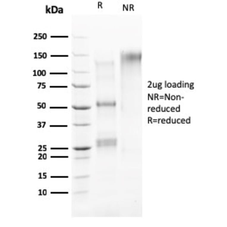 SDS-PAGE - Anti-HER4 Antibody [ERBB4/2581] - BSA and Azide free (A251642) - Antibodies.com