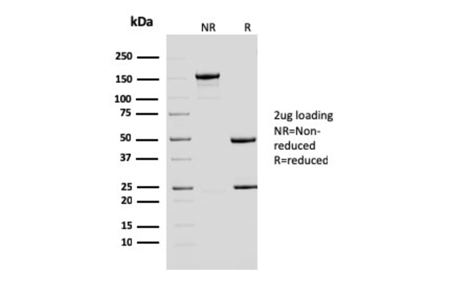 SDS-PAGE - Anti-ERCC1 Antibody [ERCC1/2683] - BSA and Azide free (A251645) - Antibodies.com