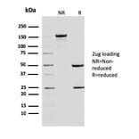 SDS-PAGE - Anti-ERCC1 Antibody [ERCC1/2683] - BSA and Azide free (A251645) - Antibodies.com