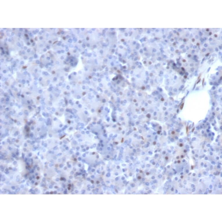 Immunohistochemistry - Anti-AKT1 Antibody [AKT1/2784] - BSA and Azide free (A251650) - Antibodies.com