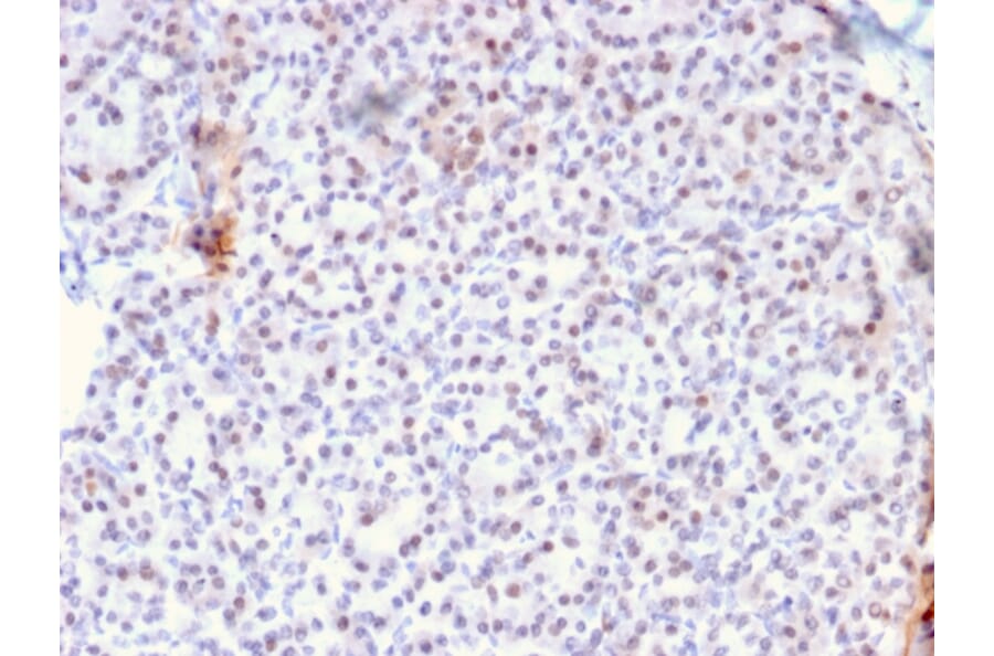 Immunohistochemistry - Anti-AKT1 Antibody [AKT1/2784] - BSA and Azide free (A251650) - Antibodies.com