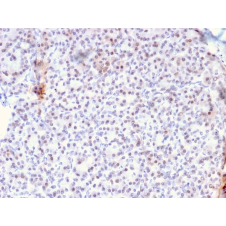 Immunohistochemistry - Anti-AKT1 Antibody [AKT1/2784] - BSA and Azide free (A251650) - Antibodies.com