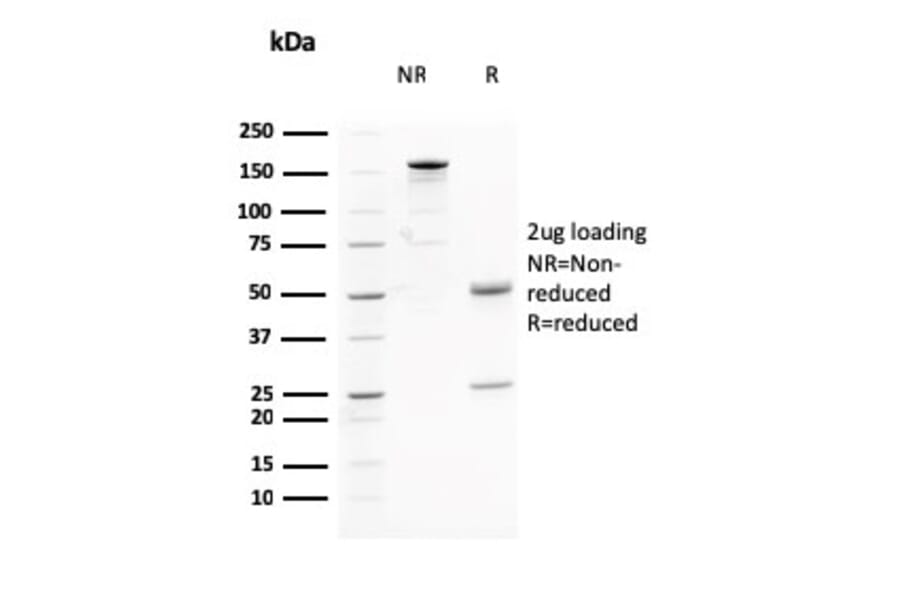 SDS-PAGE - Anti-AKT1 Antibody [AKT1/2784] - BSA and Azide free (A251650) - Antibodies.com