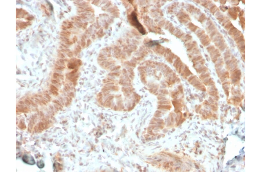 Immunohistochemistry - Anti-AKT1 Antibody [rAKT1/2491] - BSA and Azide free (A251650) - Antibodies.com