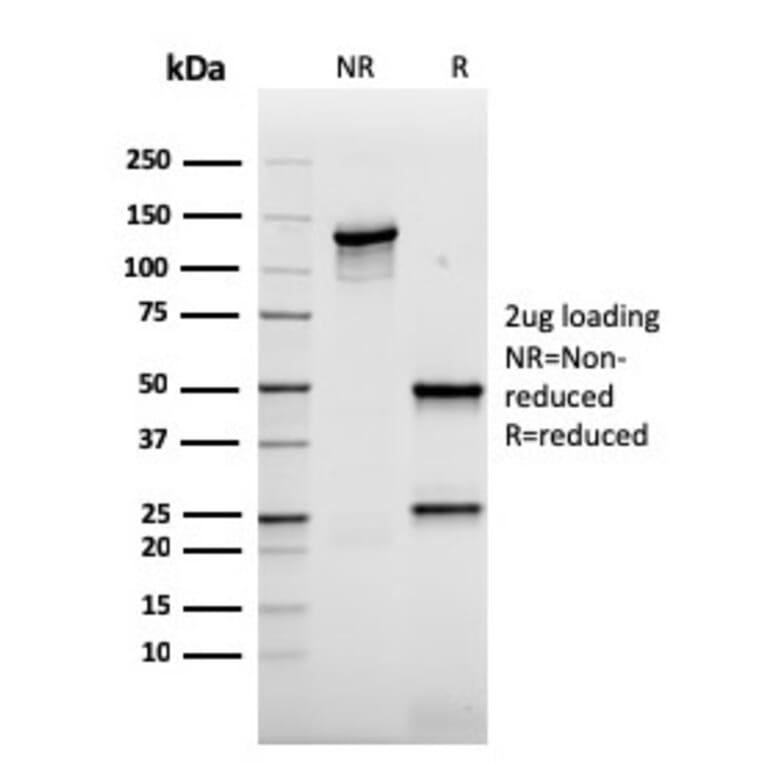 SDS-PAGE - Anti-AKT1 Antibody [rAKT1/2491] - BSA and Azide free (A251651) - Antibodies.com