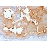 Immunohistochemistry - Anti-AKT1 Antibody [rAKT1/2491] - BSA and Azide free (A251651) - Antibodies.com