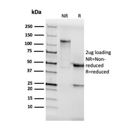 SDS-PAGE - Anti-AKT1 Antibody [AKT1/3898R] - BSA and Azide free (A251651) - Antibodies.com