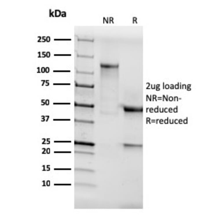 SDS-PAGE - Anti-AKT1 Antibody [AKT1/3898R] - BSA and Azide free (A251651) - Antibodies.com