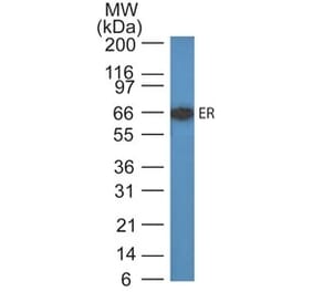 Western Blot - Anti-Estrogen Receptor Antibody [ER505] - BSA and Azide free (A251656) - Antibodies.com