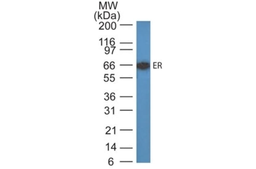Western Blot - Anti-Estrogen Receptor Antibody [ER505] - BSA and Azide free (A251656) - Antibodies.com