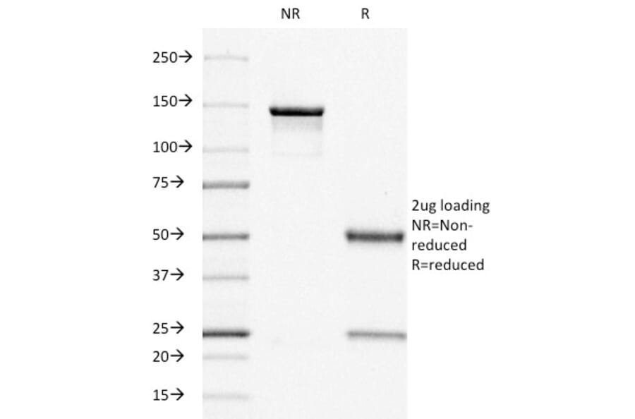 SDS-PAGE - Anti-Estrogen Receptor Antibody [ER505] - BSA and Azide free (A251655) - Antibodies.com