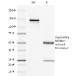 SDS-PAGE - Anti-Estrogen Receptor Antibody [ER505] - BSA and Azide free (A251655) - Antibodies.com