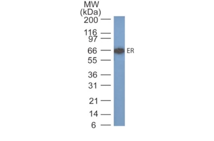 Western Blot - Anti-Estrogen Receptor alpha Antibody [SPM567] - BSA and Azide free (A251656) - Antibodies.com