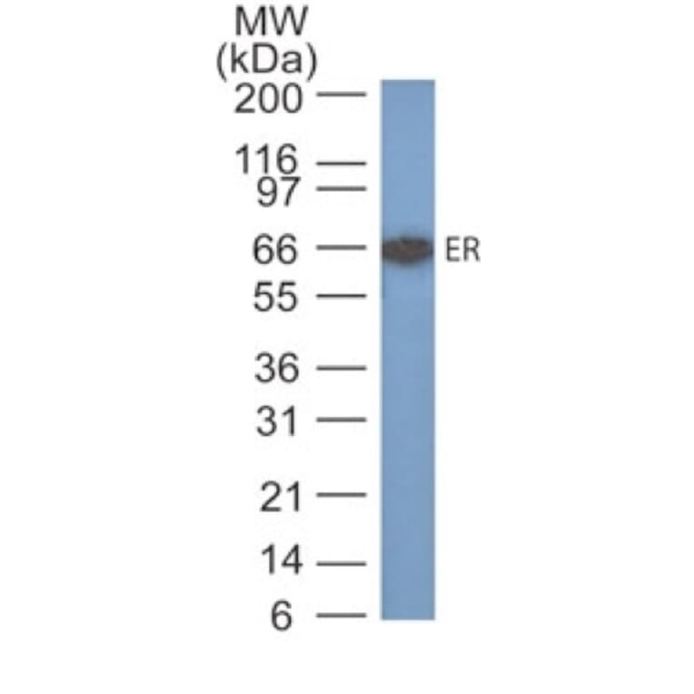 Western Blot - Anti-Estrogen Receptor alpha Antibody [SPM567] - BSA and Azide free (A251656) - Antibodies.com