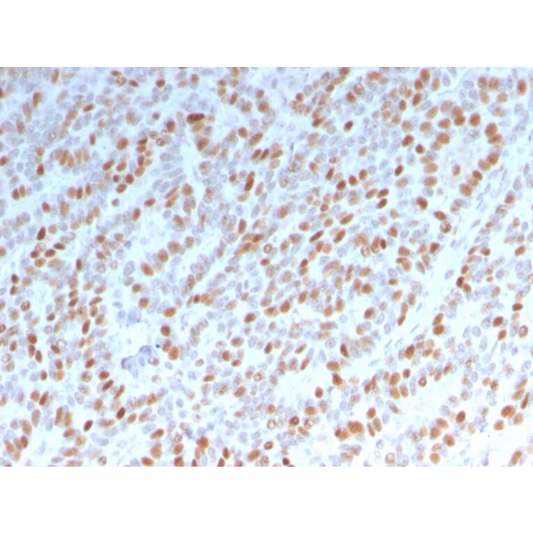 Immunohistochemistry - Anti-Estrogen Receptor alpha Antibody [ESR1/3342] - BSA and Azide free (A251658) - Antibodies.com