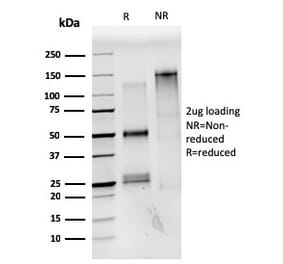 SDS-PAGE - Anti-Estrogen Receptor alpha Antibody [ESR1/3559] - BSA and Azide free (A251662) - Antibodies.com