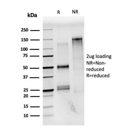 SDS-PAGE - Anti-Estrogen Receptor alpha Antibody [ESR1/3559] - BSA and Azide free (A251662) - Antibodies.com