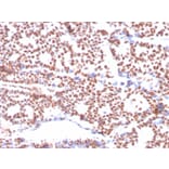 Immunohistochemistry - Anti-Estrogen Receptor alpha Antibody [ESR1/3564] - BSA and Azide free (A251664) - Antibodies.com