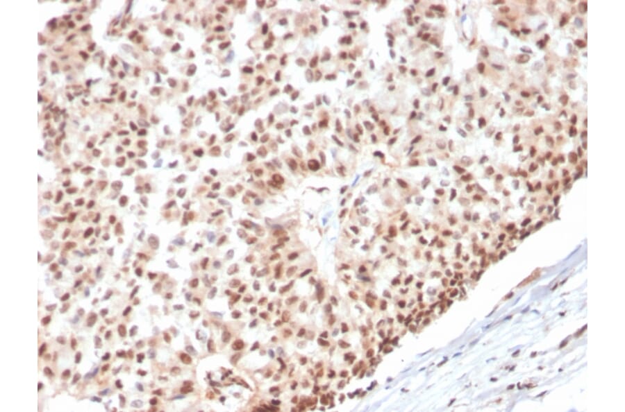 Immunohistochemistry - Anti-Estrogen Receptor alpha Antibody [ESR1/3565] - BSA and Azide free (A251665) - Antibodies.com