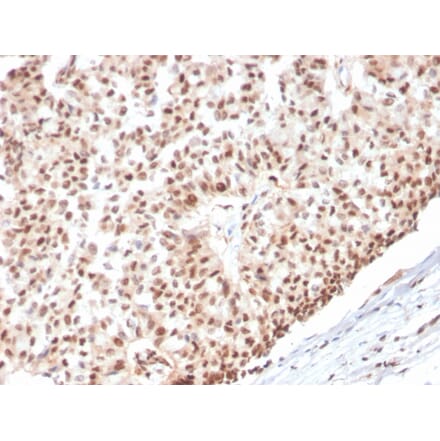 Immunohistochemistry - Anti-Estrogen Receptor alpha Antibody [ESR1/3565] - BSA and Azide free (A251665) - Antibodies.com