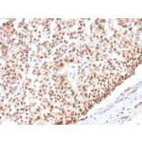 Immunohistochemistry - Anti-Estrogen Receptor alpha Antibody [ESR1/3565] - BSA and Azide free (A251665) - Antibodies.com