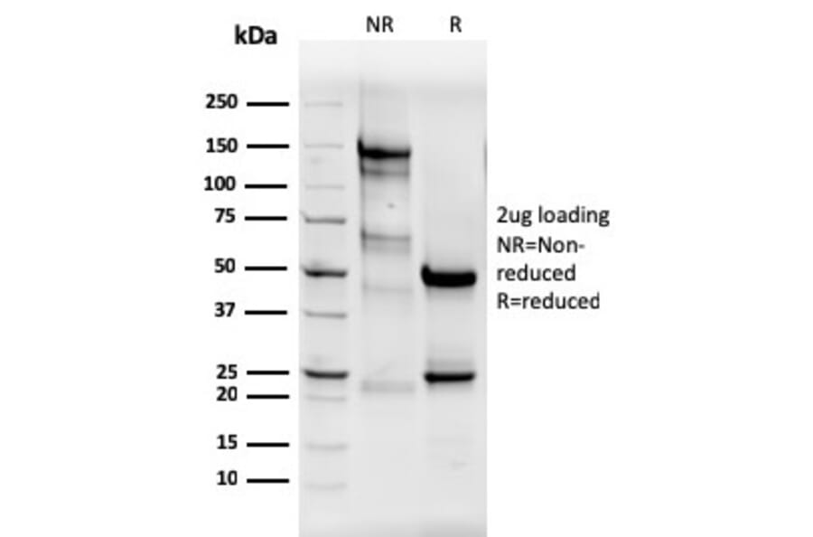 SDS-PAGE - Anti-Estrogen Receptor alpha Antibody [ESR1/3565] - BSA and Azide free (A251665) - Antibodies.com