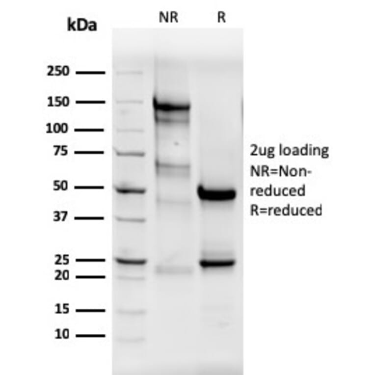 SDS-PAGE - Anti-Estrogen Receptor alpha Antibody [ESR1/3565] - BSA and Azide free (A251665) - Antibodies.com