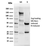 SDS-PAGE - Anti-Estrogen Receptor alpha Antibody [ESR1/3565] - BSA and Azide free (A251665) - Antibodies.com