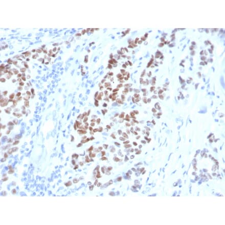 Immunohistochemistry - Anti-Estrogen Receptor alpha Antibody [ESR1/4008] - BSA and Azide free (A251666) - Antibodies.com