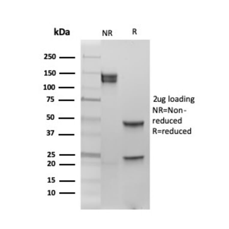 SDS-PAGE - Anti-Estrogen Receptor beta 1 Antibody [PGP5/10] - BSA and Azide free (A251669) - Antibodies.com