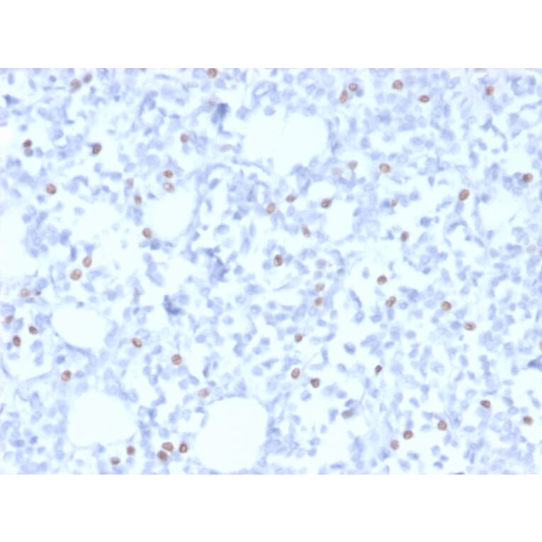 Immunohistochemistry - Anti-Estrogen Receptor beta 1 Antibody [PGP5/10] - BSA and Azide free (A251669) - Antibodies.com