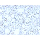 Immunohistochemistry - Anti-Estrogen Receptor beta 1 Antibody [PGP5/10] - BSA and Azide free (A251669) - Antibodies.com