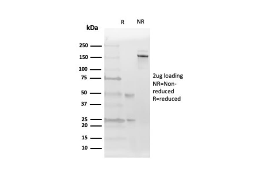 SDS-PAGE - Anti-Estrogen Receptor beta 2 Antibody [57/3] - BSA and Azide free (A251670) - Antibodies.com