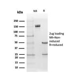 SDS-PAGE - Anti-Estrogen Receptor beta 5 Antibody [PPG5/25] - BSA and Azide free (A251671) - Antibodies.com