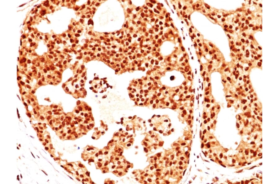 Immunohistochemistry - Anti-Estrogen Receptor beta 1 Antibody [ERb455] - BSA and Azide free (A251672) - Antibodies.com
