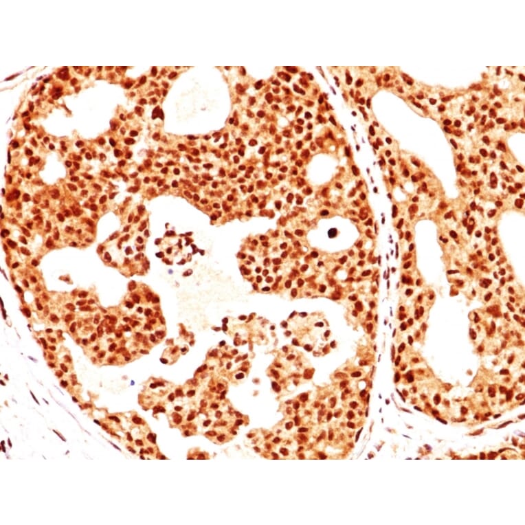 Immunohistochemistry - Anti-Estrogen Receptor beta 1 Antibody [ERb455] - BSA and Azide free (A251672) - Antibodies.com